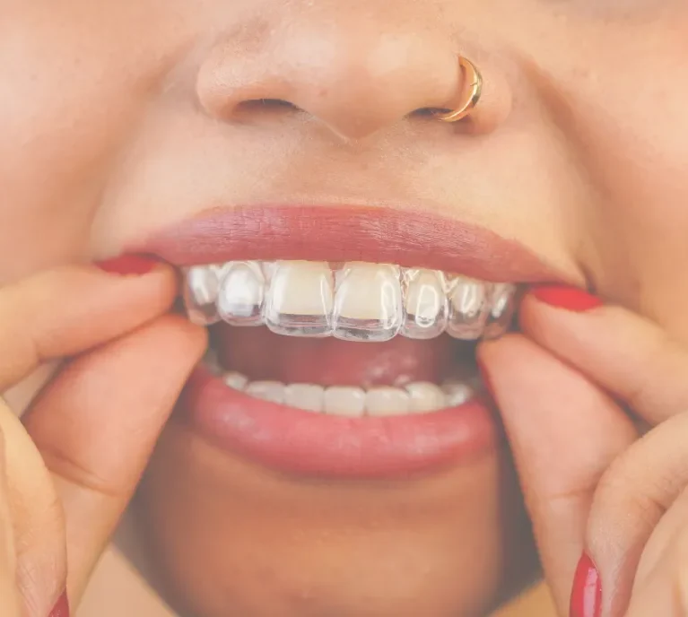 Aligner treatment can help patients explore a straighter smile with clear guidance before treatment begins. || Suitability depends on your teeth, bite and goals, so the team can explain what may be realistic before you decide.
